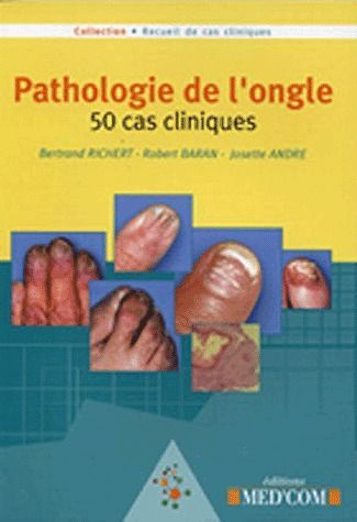 Pathologie de l'ongle. 50 cas cliniques