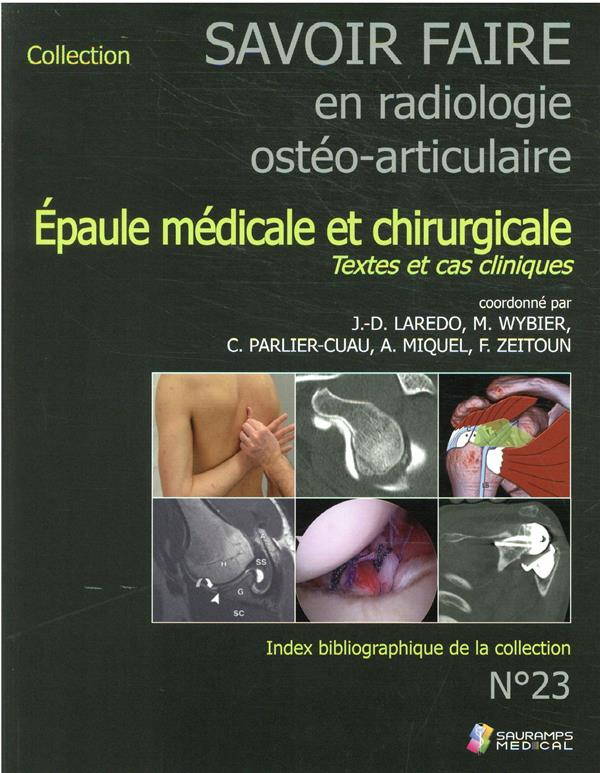 Savoir faire en radiologie ostéo-articulaire. Volume 23. Epaule médicale et chirurgicale