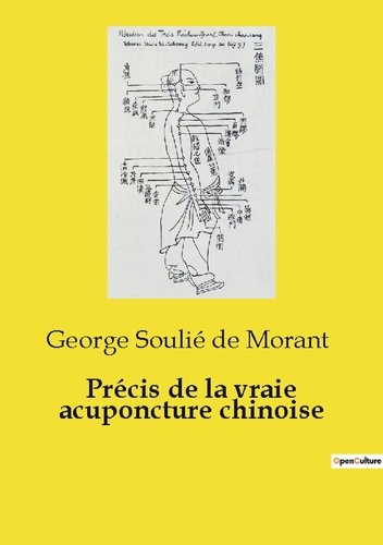 Précis de la vraie acuponcture chinoise