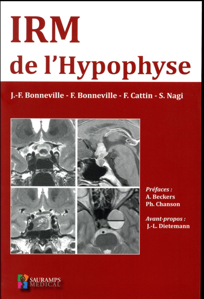 Bonneville_Jean-Fran_ois_Bonneville_Fabrice_Ca-IRM_de_l_hypophyse-9791030301281_0