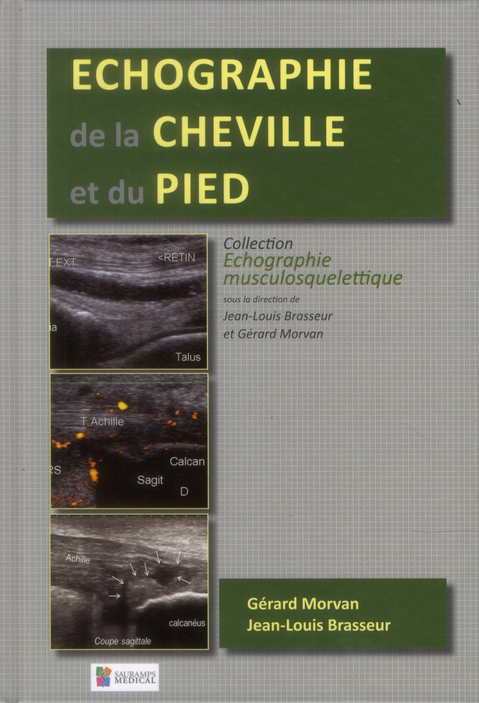 Brasseur_Jean-Louis_Morvan_G_rard-Echographie_de_la_cheville_et_du_pied-9782840238584_0