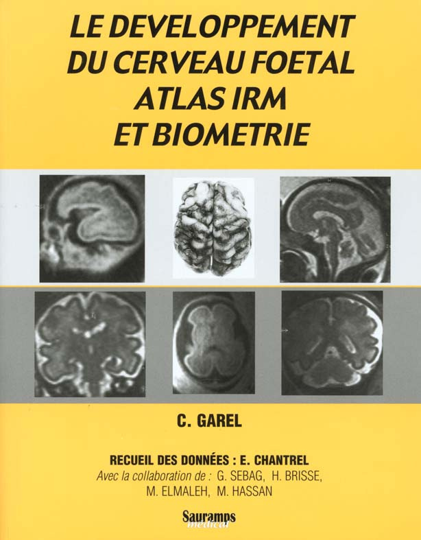 Brisse_Herv_Elmaleh_M_Garel_C_Hassan_M_Se-Le_d_veloppement_du_cerveau_foetal_Atlas_IRM_et_biom_trie-9782840232452_0