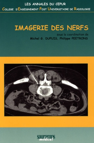 Dupuis_M._G._Peetrons_Philippe_Batch_T_Bauhe-Imagerie_des_nerfs-9782840235750_0