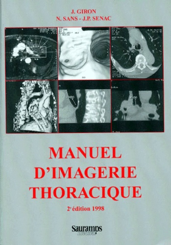 Giron_J_Sans_Neus_S_nac_Jean-Paul-MANUEL_D_IMAGERIE_THORACIQUE._2_me_dition_1998-9782840231752_0