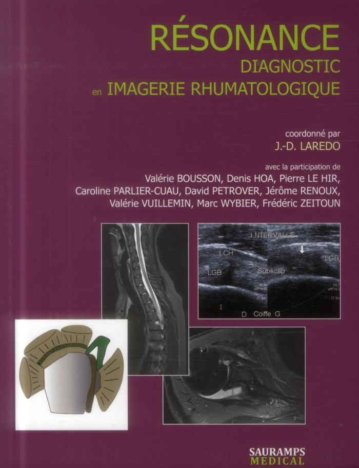 Laredo_Jean-Denis-R_sonance._Diagnostic_en_imagerie_rhumatologique-9782840239581_0