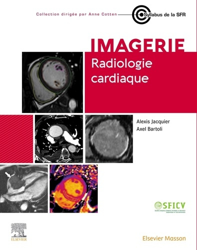 jacquier-alexis-bartoli-axel-radiologie-cardiaque_0