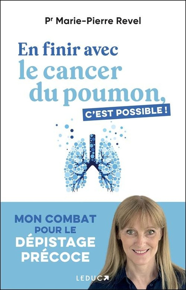 revel-marie-pierre-en-finir-avec-le-cancer-du-poumon_0