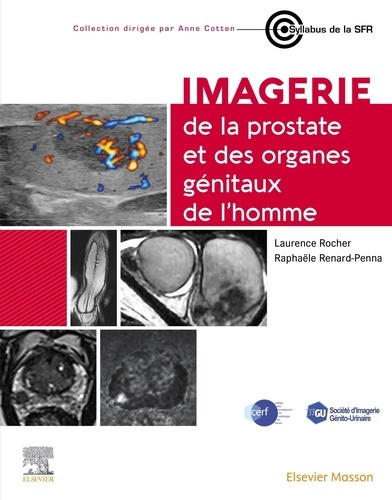 rocher-laurence-renard-penna-raphaelle-imagerie-de-la-prostate-et-des-organes-genitaux-de-l-homme_0