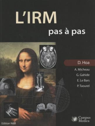 L'IRM pas à pas
