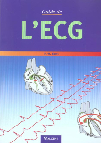 Guide de l'ECG