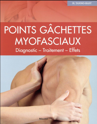 Points gâchettes myofasciaux. Diagnostics - Traitement - Effets