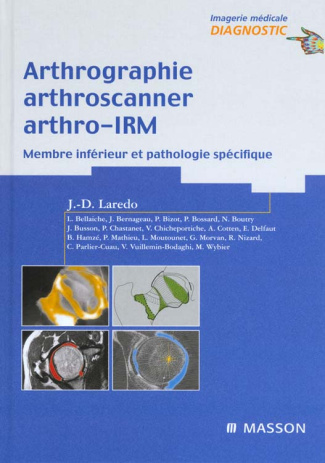 Arthrographie, arthroscanner, arthro-IRM. Membre inférieur et pathologie spécifique