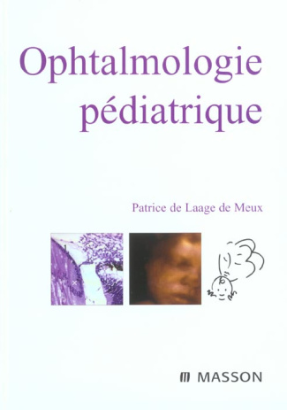 Ophtalmologie pédiatrique