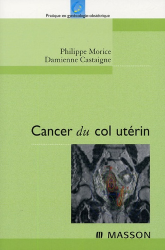 CANCER DU COL UTERIN