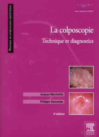 La colposcopie / Technique et diagnostics