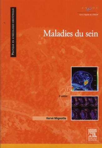 Maladies du sein . 2e édition
