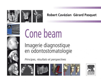 CONE BEAM : IMAGERIE DIAGNOSTIQUE EN ODONTOSTOMATOLOGIE - PRINCIPES, RESULTATS ET PERSPECTIVES