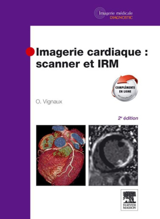 Imagerie cardiaque : scanner et IRM. 2e édition