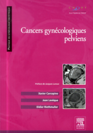 Cancers gynécologiques pelviens