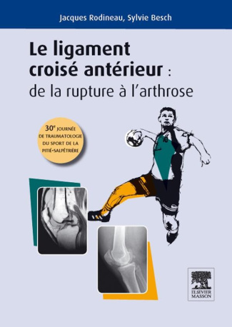 Le ligament croisé antérieur : De la rupture à l?arthrose. 30e journée de traumatologie du sport et