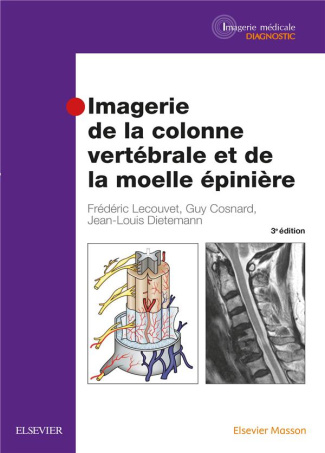 Imagerie de la colonne vertébrale et de la moelle épinière. 3e édition