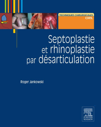 Septoplastie et rhinoplastie par désarticulation. Histoire, anatomie, chirurgie et architecture natu