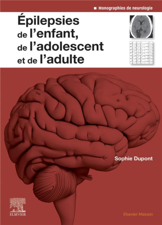 Epilepsies de l'enfant, de l'adolescent et de l'adulte