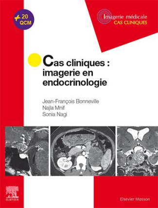 Cas cliniques : imagerie en endocrinologie