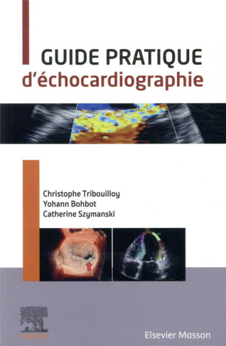 Guide pratique d'échocardiographie
