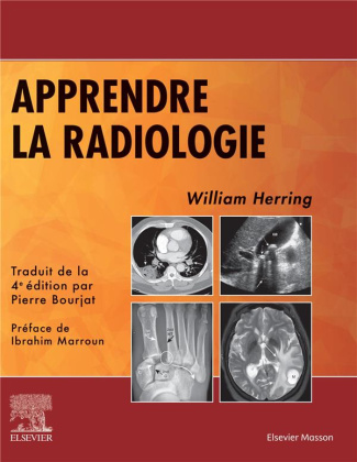 Apprendre la radiologie. 4e édition