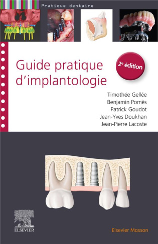 Guide pratique d'implantologie. 2e édition