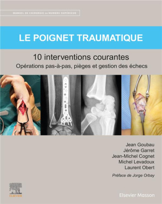 Le poignet traumatique : 10 interventions courantes. Manuel de chirurgie du membre supérieur