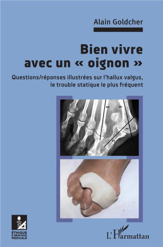 Bien vivre avec un "oignon". Questions/réponses illsutrées sur l'hallux valgus, le trouble statique