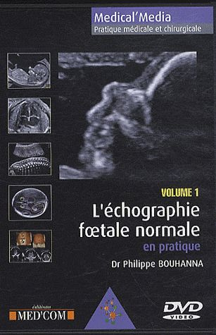 L'Echographie foetale normale en pratique volume 1. DVD vidéo