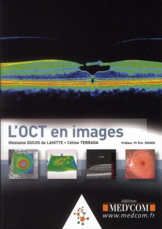 L'OCT en images