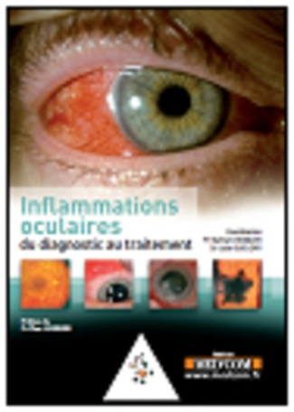 L'inflammation oculaire