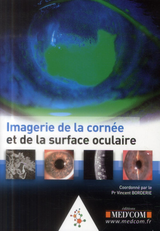 Image de la cornée et de la surface oculaire