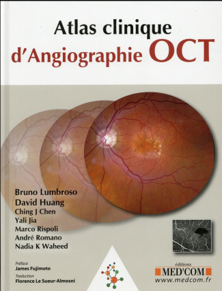 Atlas clinique d'angiographie OCT