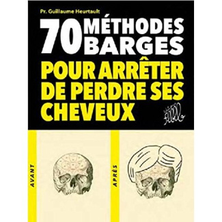 70 méthodes barges pour arrêter de perdre ses cheveux