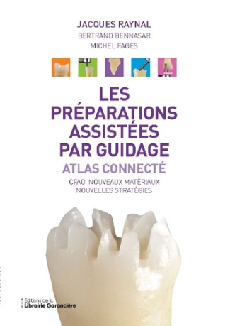 Les préparations assistées par guidage. Atlas connecté
