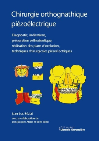Chirurgie orthognathique piézoélectrique. Diagnostic, indications, préparation orthodontique, réalis