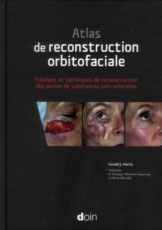Atlas de reconstruction oculofaciale. Principes et techniques de reconstruction des pertes de substa
