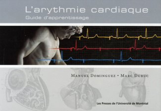 Arythmie cardiaque. Guide d'apprentissage