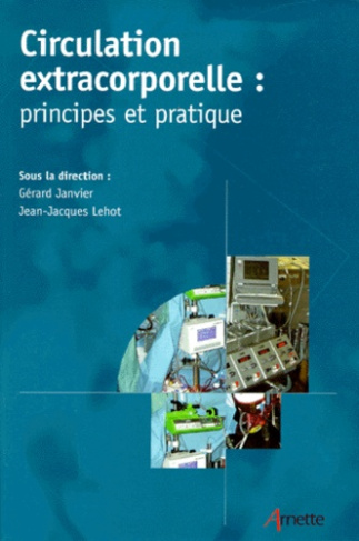 Circulation extracorporelle : principes et pratique