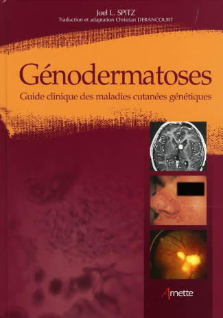 Génodermatoses. Guide clinique des maladies cutanées génétiques