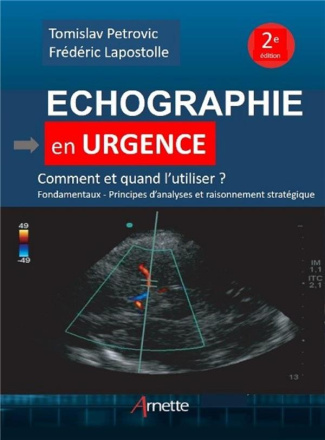 Echographie en urgence. Comment et quand l'utiliser ? 2e édition