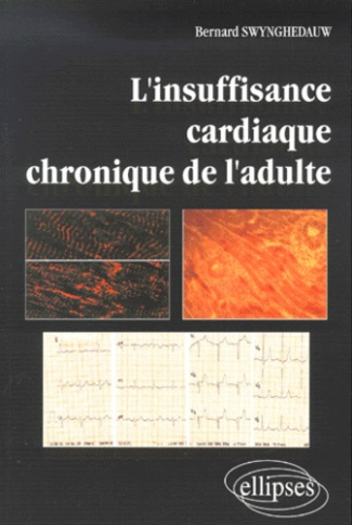 L'insuffisance cardiaque chronique de l'adulte