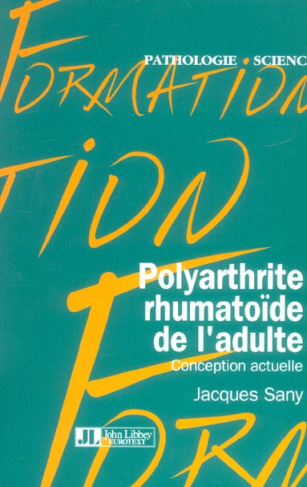 Polyarthrite rhumatoïde de l'adulte : conception actuelle