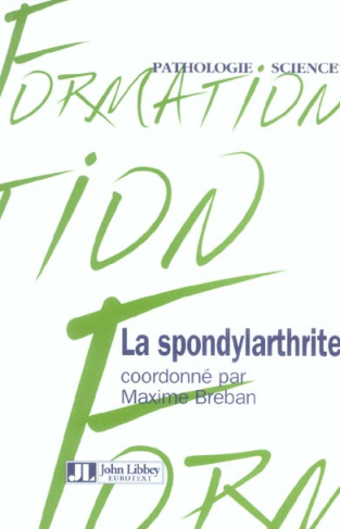LA SPONDYLARTHRITE