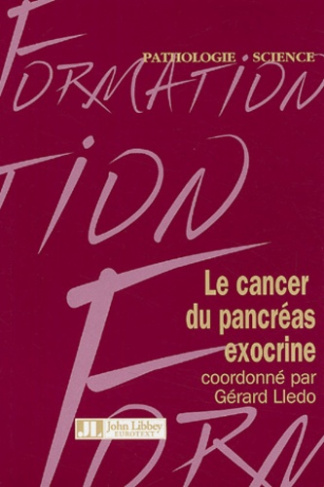Le cancer du pancréas exocrine